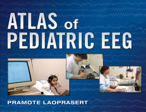 Atlas of Pediatric EEG (Atlas Series)