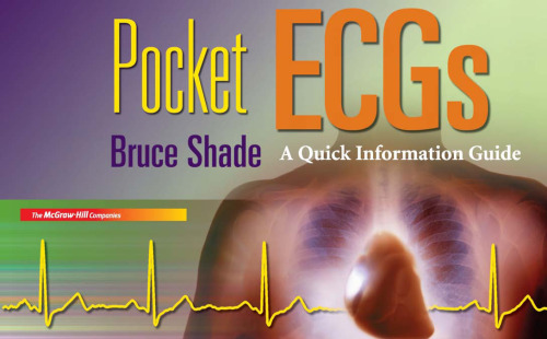 Pocket ECGs: A Quick Information Guide