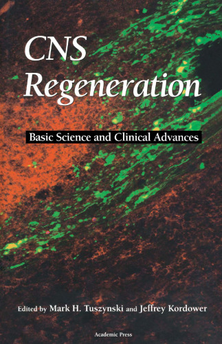 CNS Regeneration: Basic Science and Clinical Advances