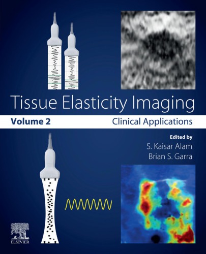 Tissue Elasticity Imaging: Volume 2: Clinical Applications