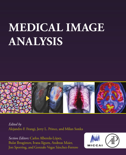 Medical Image Analysis (The MICCAI Society book Series)