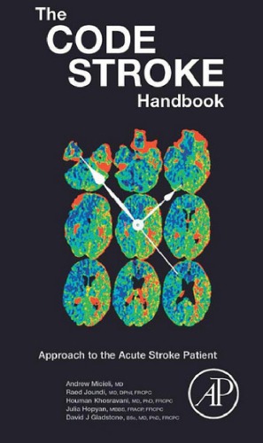 The Code Stroke Handbook: Approach to the Acute Stroke Patient