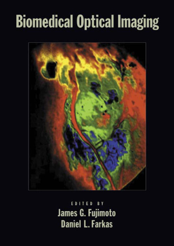 Biomedical optical imaging