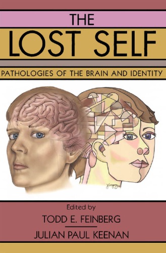 The Lost Self: Pathologies of the Brain and Identity