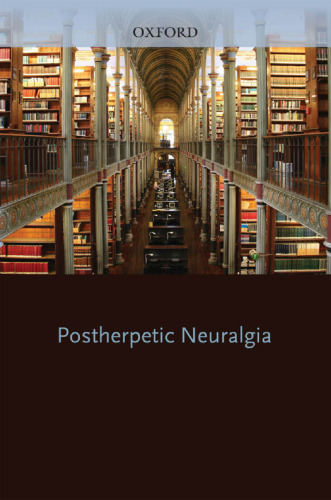Oxford American Pocket Notes Post Herpetic Neuralgia