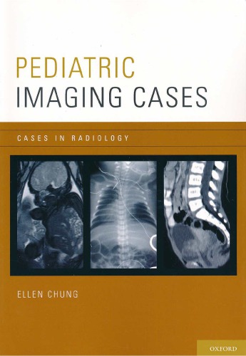 Pediatric Imaging Cases (Cases in Radiology)