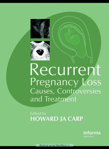 Recurrent Pregnancy Loss: Causes, Controversies and Treatment