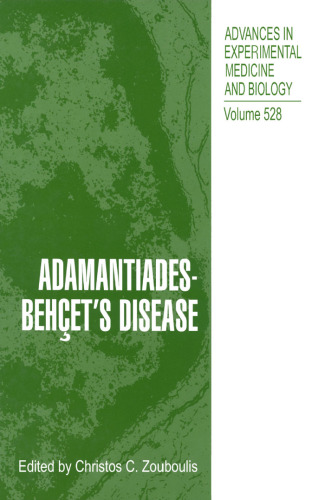 Adamantiades-Behçet’s Disease