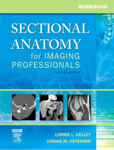 Sectional Anatomy for Imaging Professionals