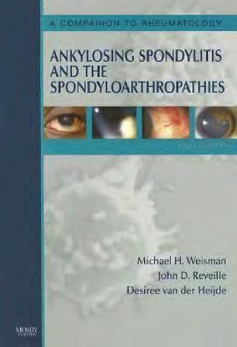 Ankylosing Spondylitis and the Spondyloarthropathies: A Companion to Rheumatology 3E