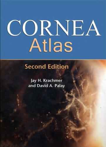 Cornea Atlas 2nd Edition