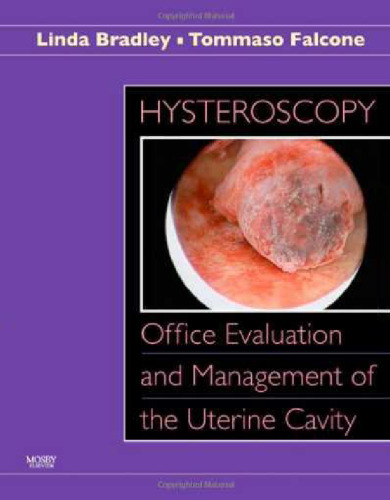 Hysteroscopy: Office Evaluation and Management of the Uterine Cavity