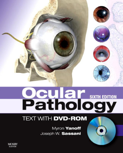Ocular Pathology, 6Th Edition