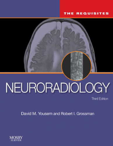 Neuroradiology: The Requisites (Expert Consult-Online and Print) (Requisites in Radiology), Third Edition