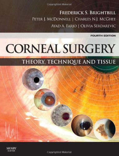 Corneal Surgery: Theory Technique and Tissue, 4e