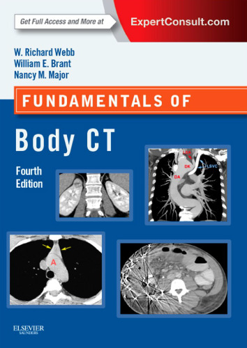 Fundamentals of Body CT, 4e