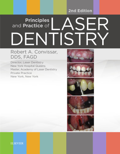 Principles and Practice of Laser Dentistry, 2e