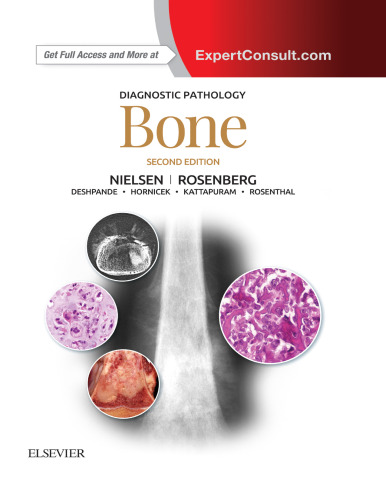 Bone
