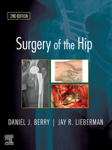 Surgery of the Hip
