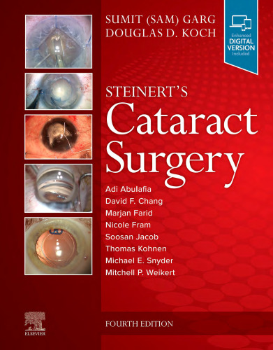 Steinert's Cataract Surgery