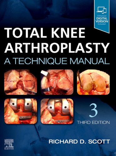 Total Knee Arthroplasty: A Technique Manual