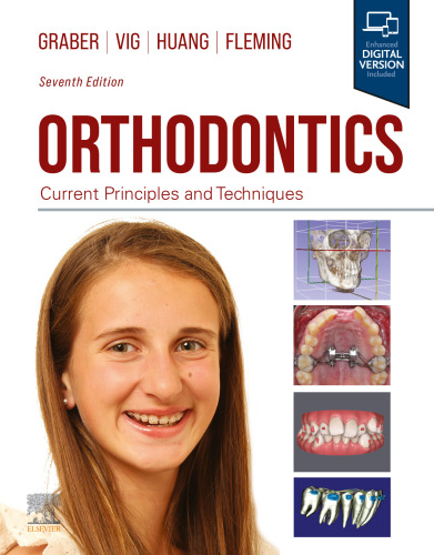 Orthodontics: Current Principles and Techniques