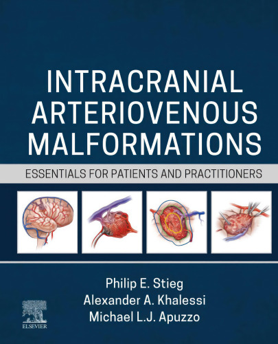 Intracranial Arteriovenous Malformations: Essentials for Patients and Practitioners