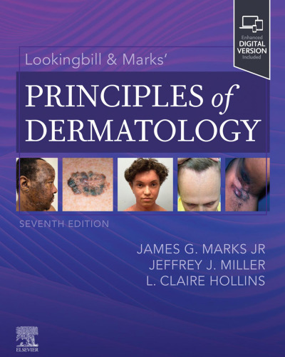 Lookingbill & Marks' Principles of Dermatology