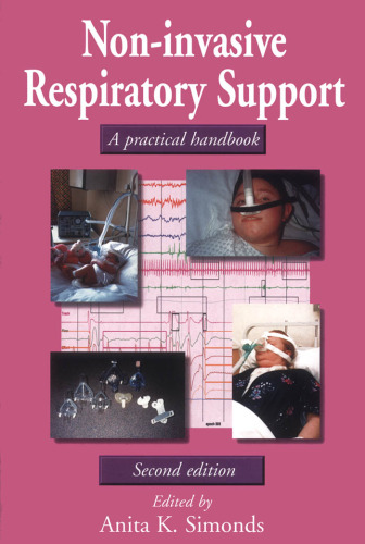 Non-invasive respiratory support: a practical handbook