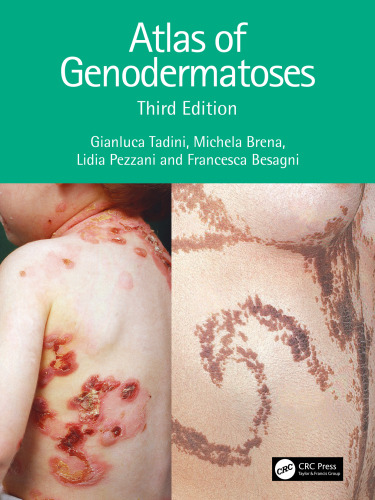 Atlas of Genodermatoses