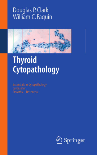 Thyroid Cytopathology (Essentials in Cytopathology)