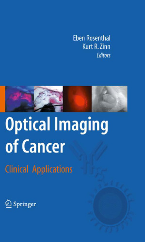 Optical Imaging of Cancer: Clinical Applications
