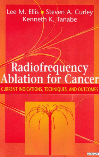 Radiofrequency Ablation for Cancer Current Indications, Techniques and Outcomes