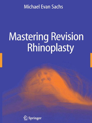Mastering Revision Rhinoplasty