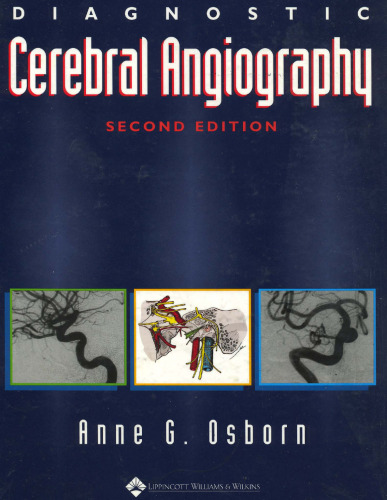 Diagnostic Cerebral Angiography
