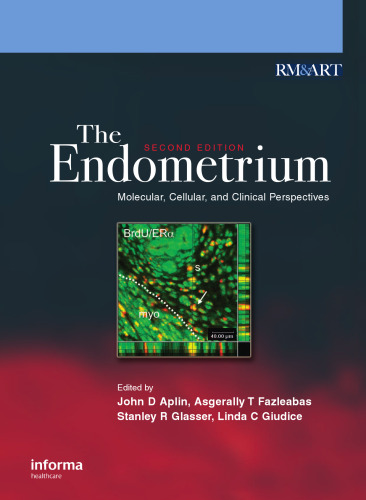 The Endometrium: Molecular, Cellular and Clinical Perspectives, 2nd edition (Reproductive Medicine & Assisted Reproductive Techniques)