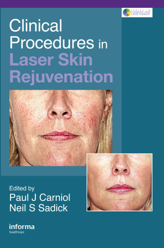 Clinical Procedures in Laser Skin Rejuvenation