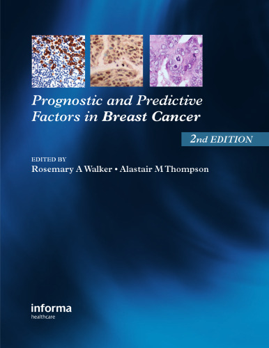 Prognostic and Predictive Factors in Breast Cancer,
