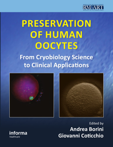 Preservation of Human Oocytes (Reproductive Medicine and Assisted Reproductive Techniques)