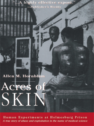 Acres of Skin: Human Experiments at Holmesburg Prison