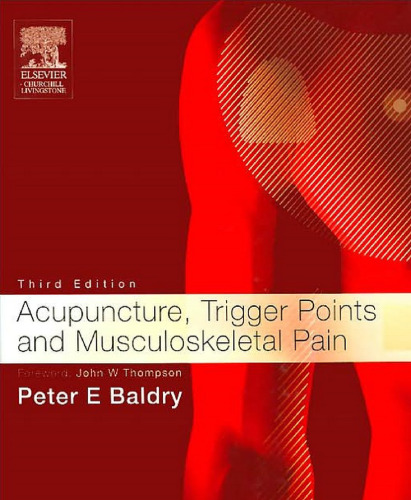 Acupuncture, Trigger Points and Musculoskeletal Pain, 3e