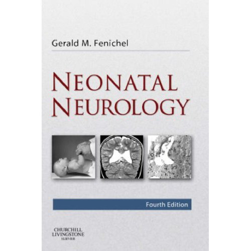 Neonatal Neurology (Fourth Edition)