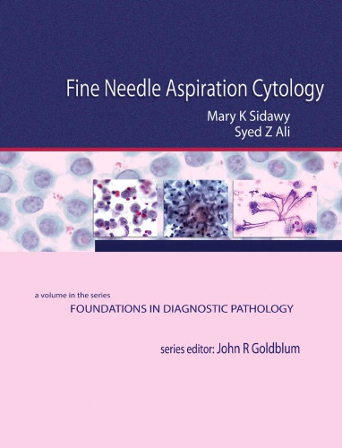Fine Needle Aspiration Cytology: A Volume in Foundations in Diagnostic Pathology
