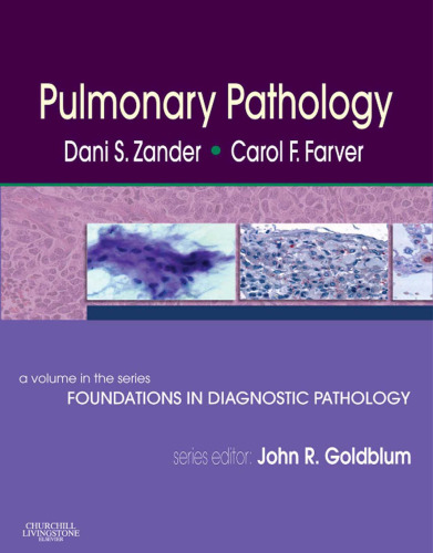 Pulmonary Pathology: A Volume in Foundations in Diagnostic Pathology Series, 1e