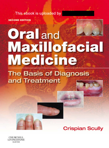 Oral and Maxillofacial Medicine: The Basis of Diagnosis and Treatment, 2e