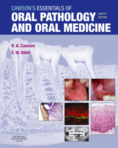 Cawson's Essentials of Oral Pathology and Oral Medicine, 8e