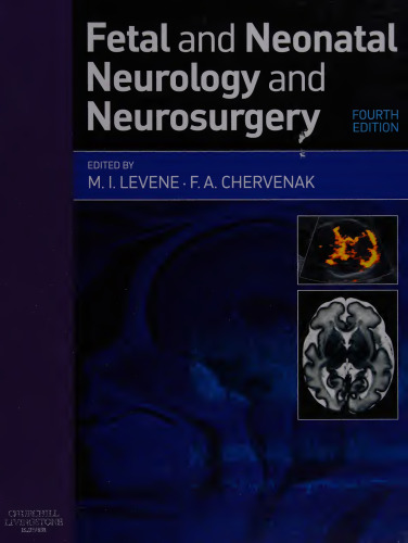 Fetal and Neonatal Neurology and Neurosurgery