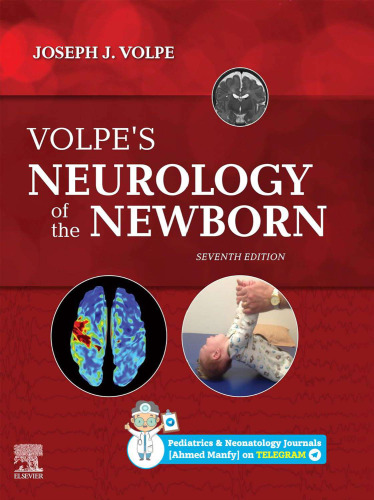 Volpe's Neurology of the Newborn