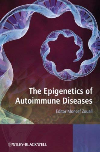 The Epigenetics of Autoimmune Diseases