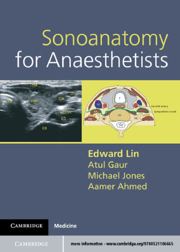 Sonoanatomy for Anaesthetists